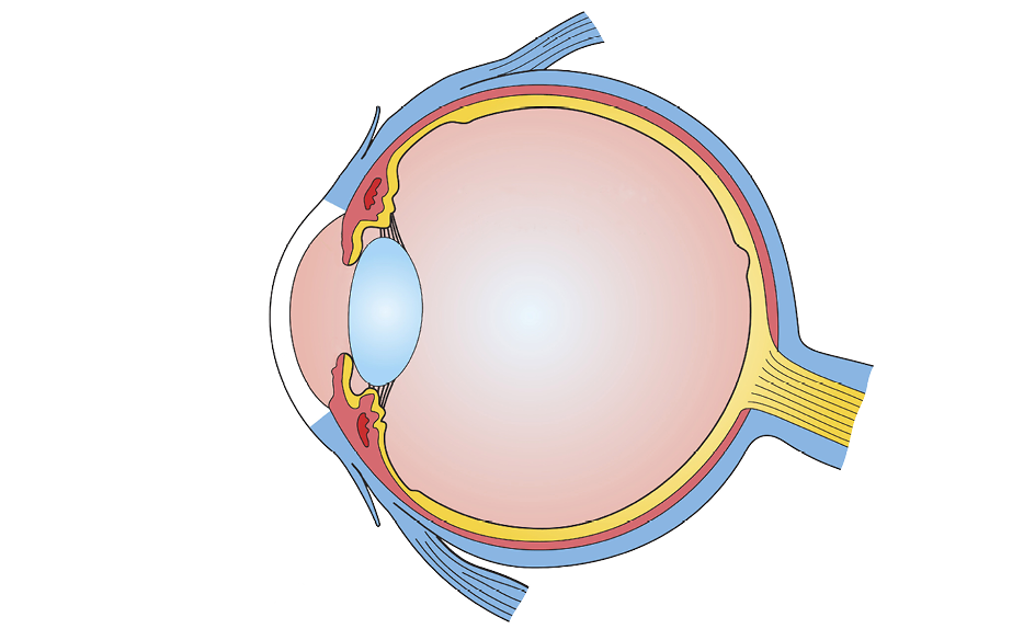 Eye anatomy, illustration. At the front of the eye is the cornea, a transparent coating. Behind this is the lens, which is partly covered by the iris. The lens focuses light on the retina at the back of the eye. Light sensitive cells in the retina transmit impulses to the brain via the optic nerve. Behind the retina is the choroid, which contains blood vessels that nourish the back of the eye. The outer layer is the sclera, the white of the eye. The eyeball is filled with a gelatinous substance called vitreous humour. Several muscles hold the eyeball in place and allow it to rotate.