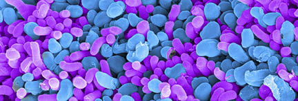 Rod and cone cells of the eye. Coloured scanning electron micrograph (SEM) of rod and cone cells in the retina of a mammalian eye. Cone cells and the more numerous rod cells are specialised light-sensitive cells that occur on the surface of the retina. They are responsible for detecting visible images, which are transmitted as nerve impulses to the optic nerve and the brain. There are about 130 million rod cells in the human retina, which detect light intensity and so are important for day and night vision. The less numerous cone-like cone cells (about 6.5 million in the human retina) respond specifically to colour. Magnification: x5,300 when printed at 10 centimetres wide.